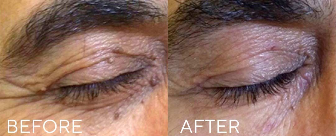 before-after-03