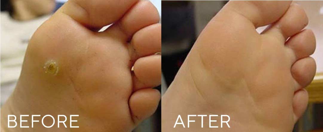 before-after-05