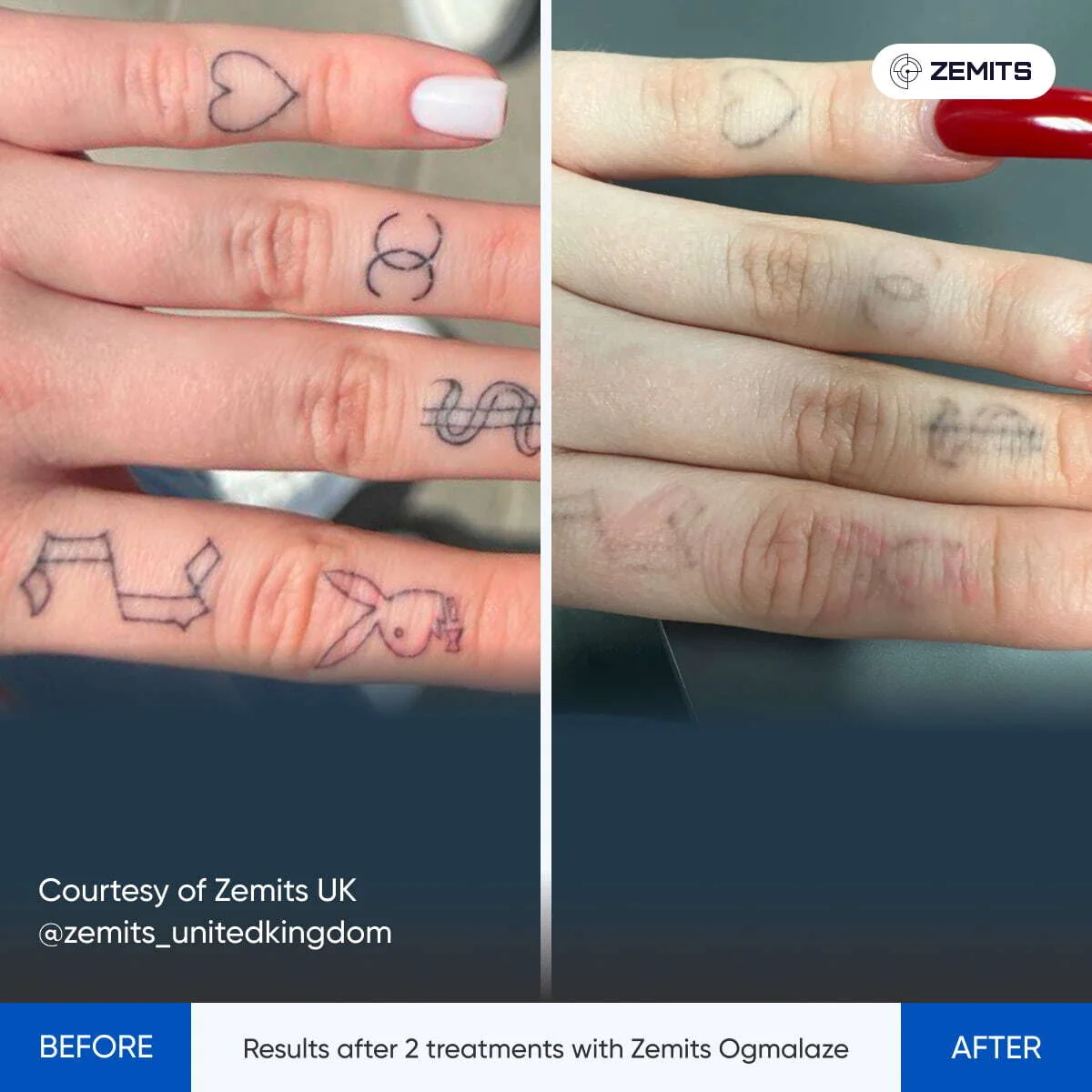 before-after-04