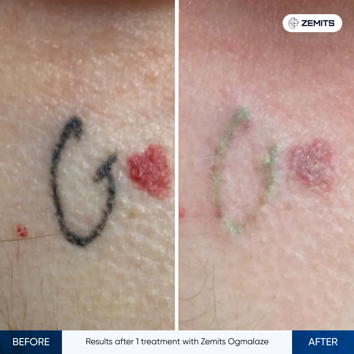 before-after-03
