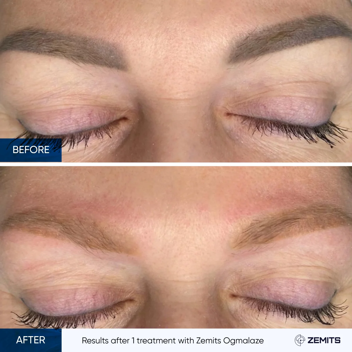 before-after-02