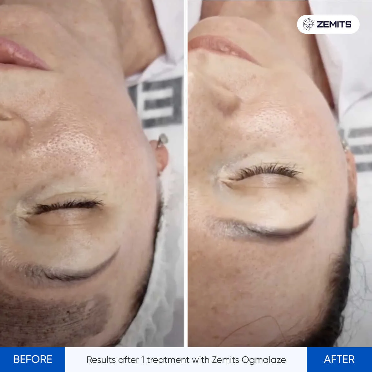 before-after-01