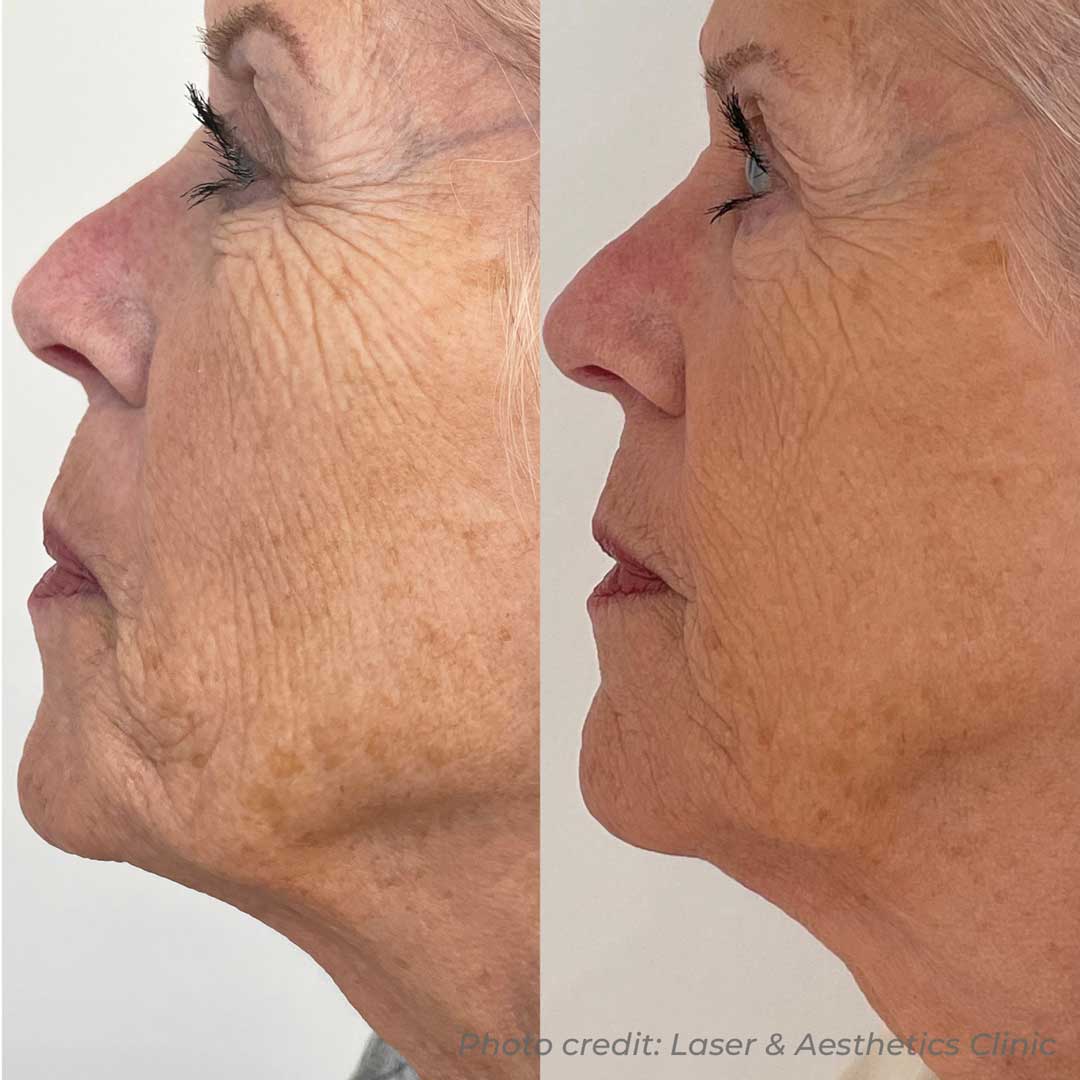 before-after-01