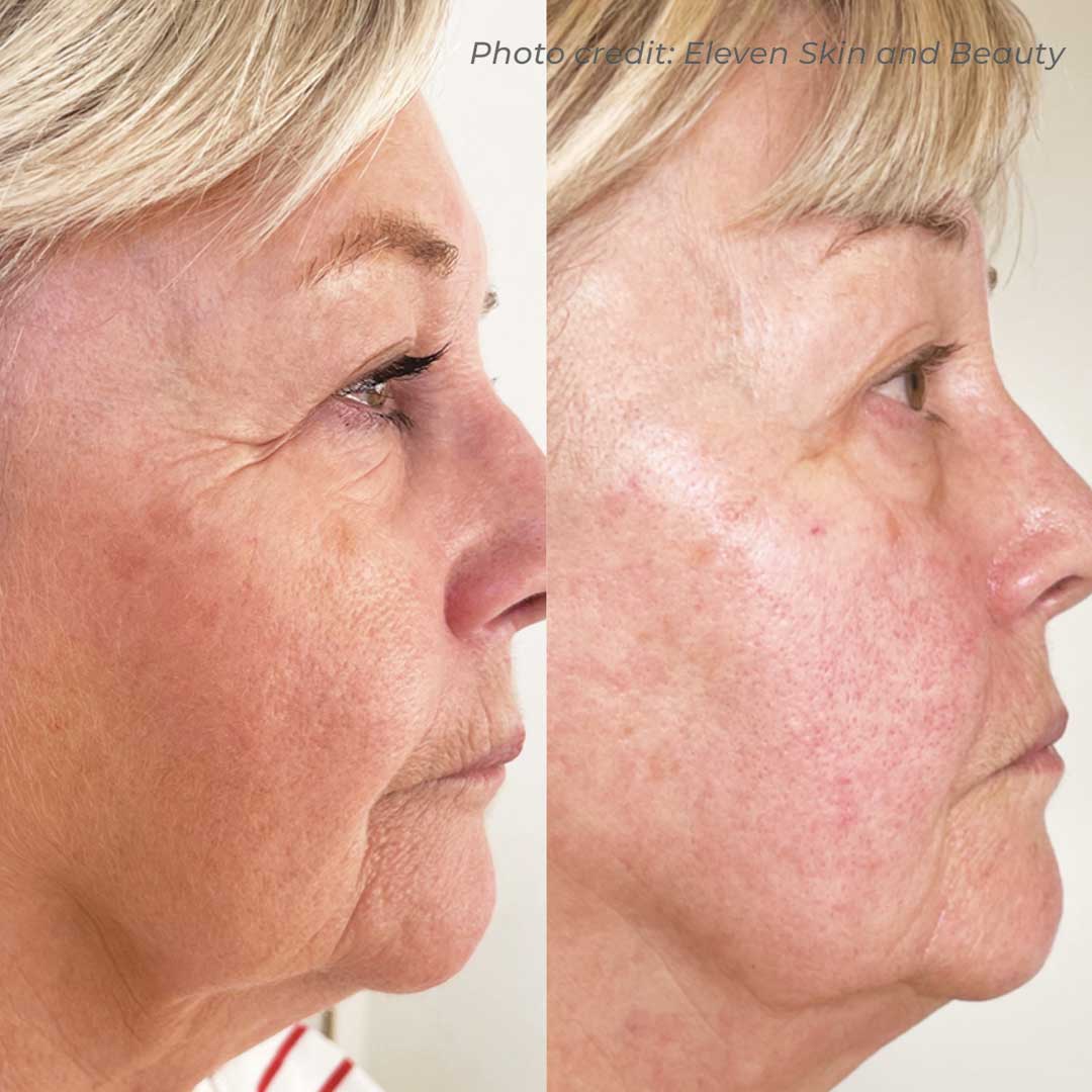 before-after-03