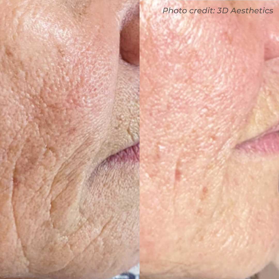 before-after-05