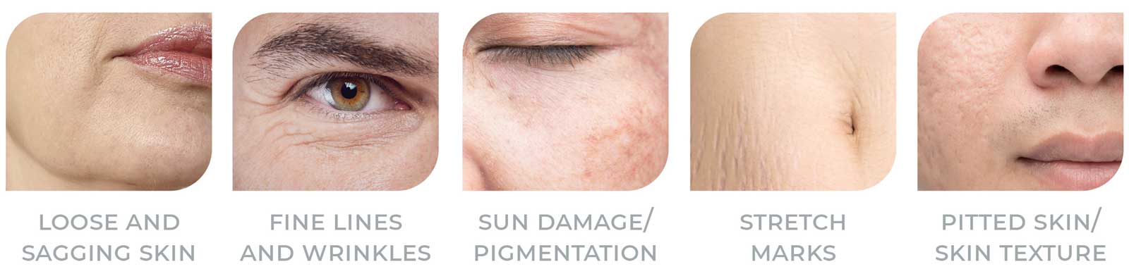 3D-Treatment-Areas